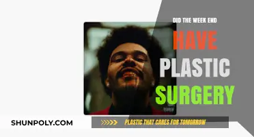 Did The Weeknd Undergo Plastic Surgery? Unraveling the Transformation Rumors
