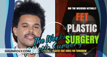 Did The Weeknd Undergo Plastic Surgery? Unraveling the Truth