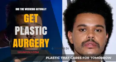 Did The Weeknd Undergo Plastic Surgery? Unraveling the Truth