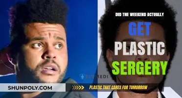 Did The Weeknd Undergo Plastic Surgery? Unraveling the Truth