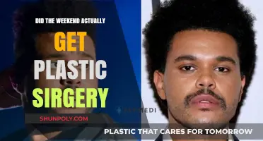 Did The Weeknd Undergo Plastic Surgery? Unraveling the Truth