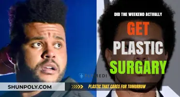 Did The Weeknd Undergo Plastic Surgery? Unraveling the Truth