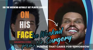 Did The Weeknd Undergo Facial Plastic Surgery? Uncovering the Truth