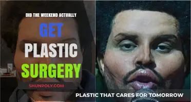 Did The Weeknd Undergo Plastic Surgery? Unraveling the Truth Behind His Look