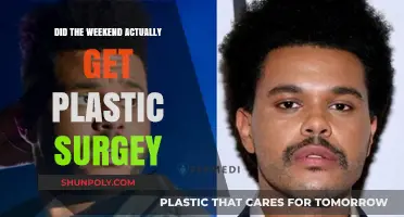 Did The Weeknd Undergo Plastic Surgery? Unraveling the Truth