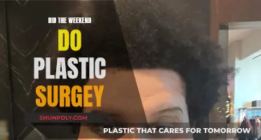Plastic Surgery Speculation: Weekend's Transformation