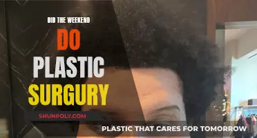 Plastic Surgery Transformation: Weekend's New Look