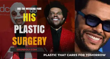 Did The Weeknd Fake His Plastic Surgery Transformation? Unveiling the Truth