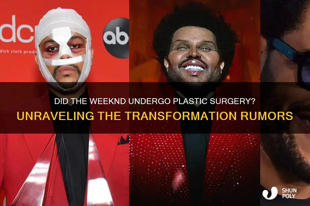 did the weekend ger plastic surgery