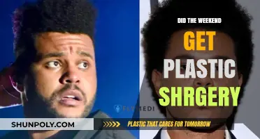 Did The Weeknd Undergo Plastic Surgery? Unraveling the Rumors and Truth
