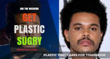Did The Weeknd Undergo Plastic Surgery? Unraveling the Rumors and Truth