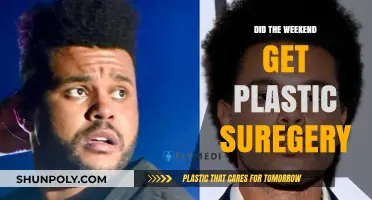 Did The Weeknd Undergo Plastic Surgery? Unraveling the Transformation Rumors