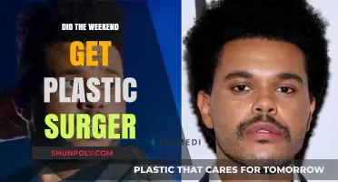 Did The Weeknd Undergo Plastic Surgery? Unraveling the Transformation Speculations