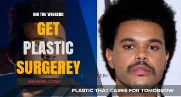 Did The Weeknd Undergo Plastic Surgery? Unraveling the Rumors and Truth