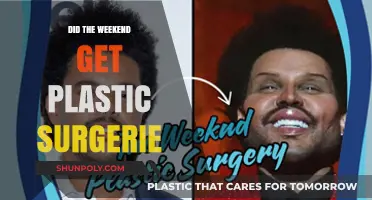 Did The Weeknd Undergo Plastic Surgery? Unraveling the Rumors and Facts