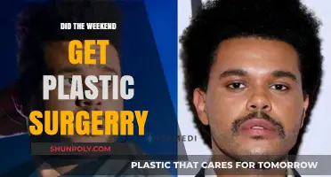 Did The Weeknd Undergo Plastic Surgery? Unraveling the Transformation Rumors