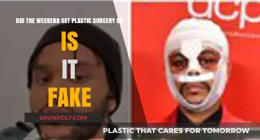 Weekend's New Look: Plastic Surgery or Just Rumors?