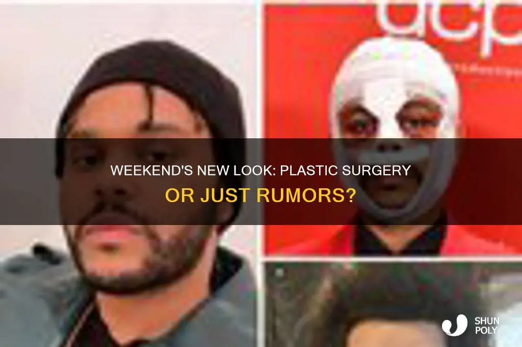 did the weekend get plastic surgery or is it fake