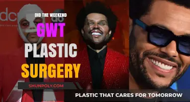 Did The Weeknd Undergo Plastic Surgery? Uncovering the Truth
