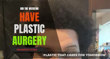 Plastic Surgery Speculation: Weekend's Transformation