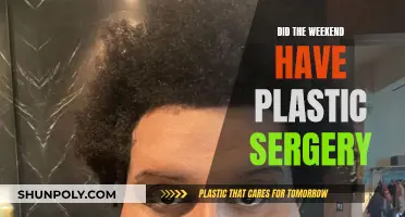 Plastic Surgery: Weekend's Transformation, Before and After