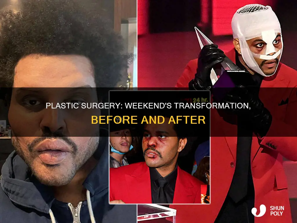 did the weekend have plastic sergery