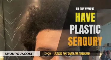 Plastic Surgery Speculations: Weekend's Transformation