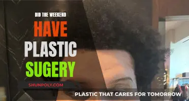 Plastic Surgery: Weekend's Transformation, a New Look?