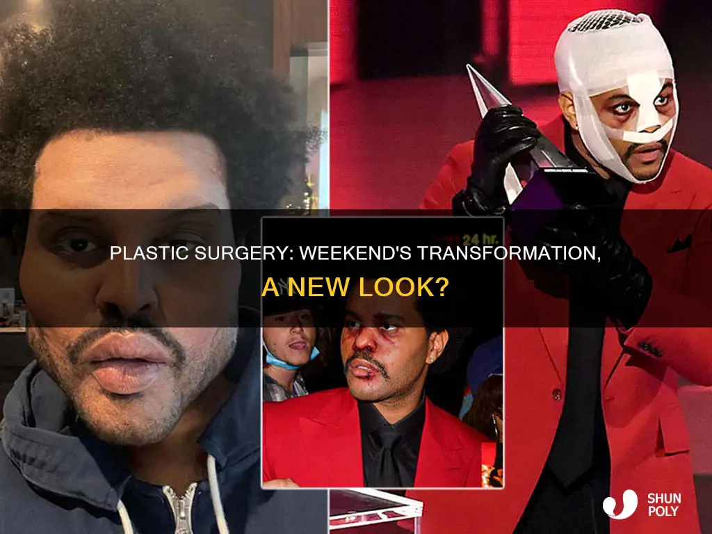 did the weekend have plastic sugery
