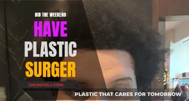 Plastic Surgery Transformation: Weekend's Dramatic Makeover