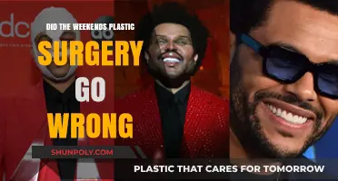 The Weeknd's Plastic Surgery: Did His New Look Go Wrong?