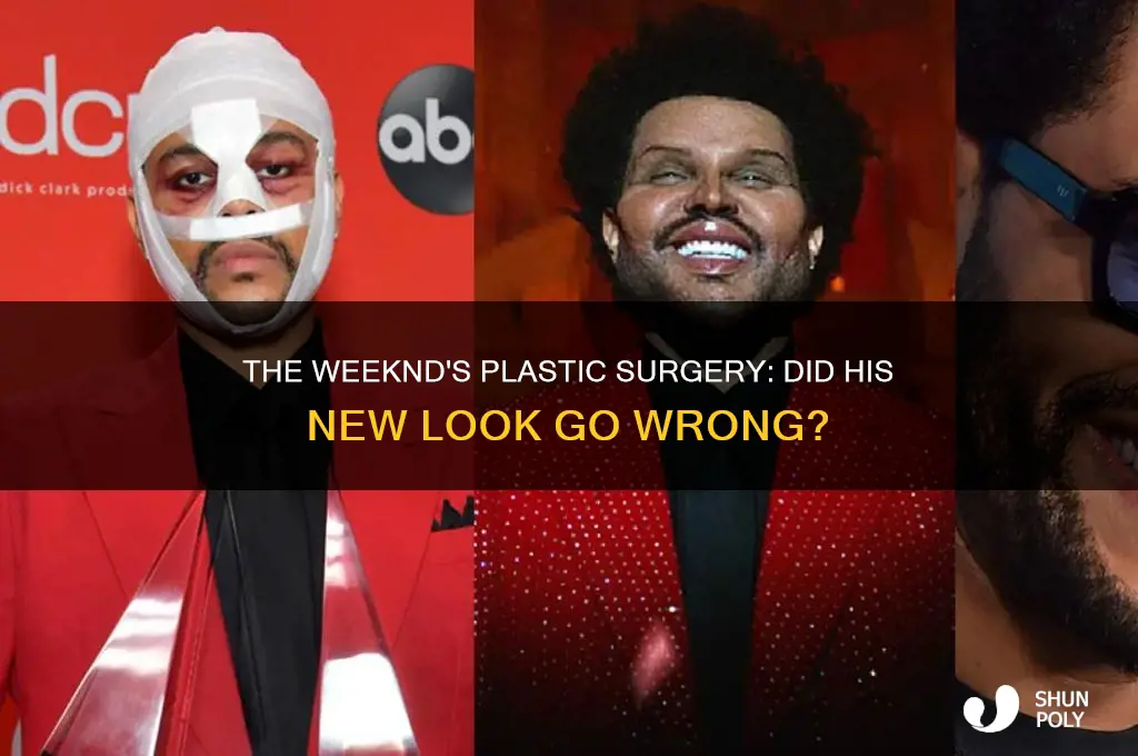 did the weekends plastic surgery go wrong