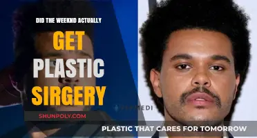 The Weeknd's Transformation: Plastic Surgery Rumors Explored