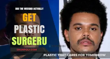 The Weeknd's Transformation: Plastic Surgery Rumors Unveiled