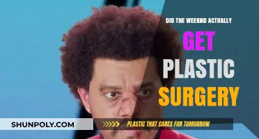 Did The Weeknd Undergo Plastic Surgery? Unraveling the Truth