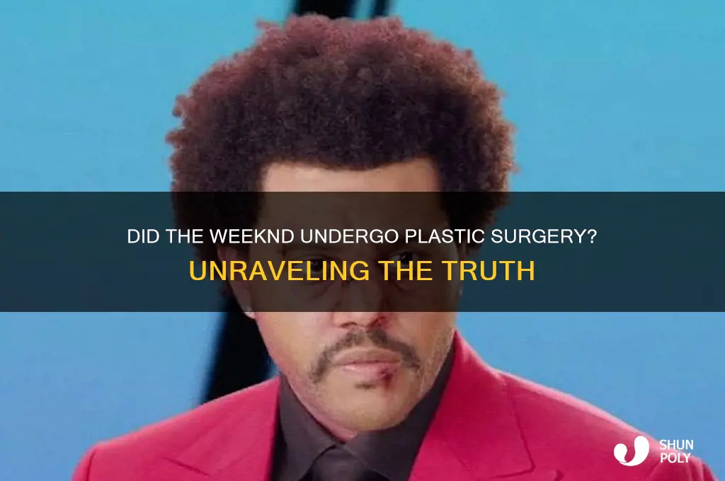 did the weeknd actually get plastic surgery