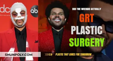 The Weeknd's Transformation: Plastic Surgery Rumors Explored and Debunked