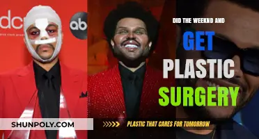 The Weeknd's Transformation: Plastic Surgery Rumors Explored and Debunked