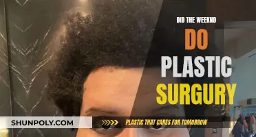 The Weeknd's Transformation: Exploring Plastic Surgery Rumors