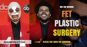 Did The Weeknd Get Plastic Surgery? Uncovering the Truth Behind His Look