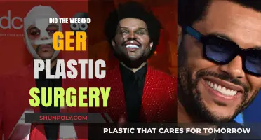 Did The Weeknd Undergo Plastic Surgery? Unveiling the Truth
