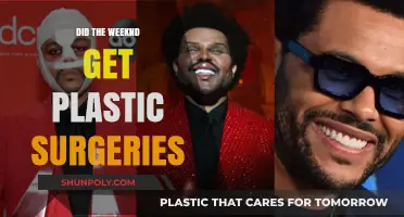 The Weeknd's Transformation: Plastic Surgery Rumors Explored and Debunked