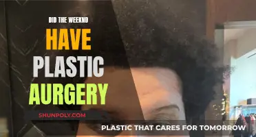 The Weeknd's Transformation: Plastic Surgery or Natural Evolution?