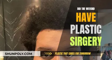 The Weeknd's Transformation: Plastic Surgery or Natural Evolution?