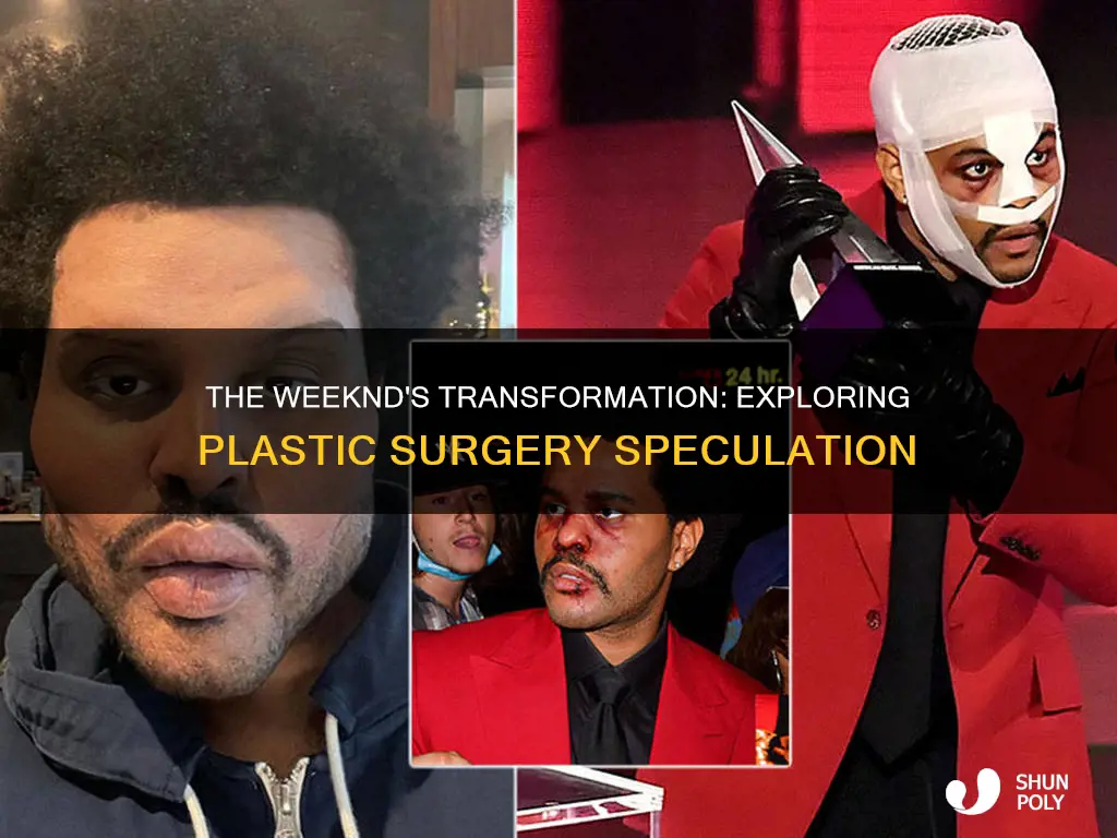 did the weeknd have plastic surfery