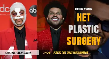 Did The Weeknd Undergo Plastic Surgery? Unveiling the Truth
