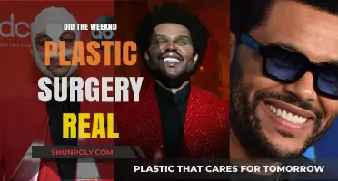 The Weeknd's Transformation: Uncovering the Truth About Plastic Surgery