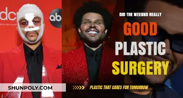 The Weeknd's Transformation: Unveiling the Truth Behind His Plastic Surgery