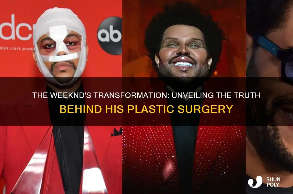 did the weeknd really good plastic surgery