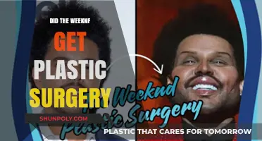 The Weeknd's Transformation: Plastic Surgery Rumors Explored and Debated